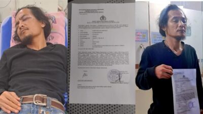 Ambarita Jurnalis Dianiaya Saat Liputan, Akhirnya Kasus Dilaporkan ke Polda Metro Jaya